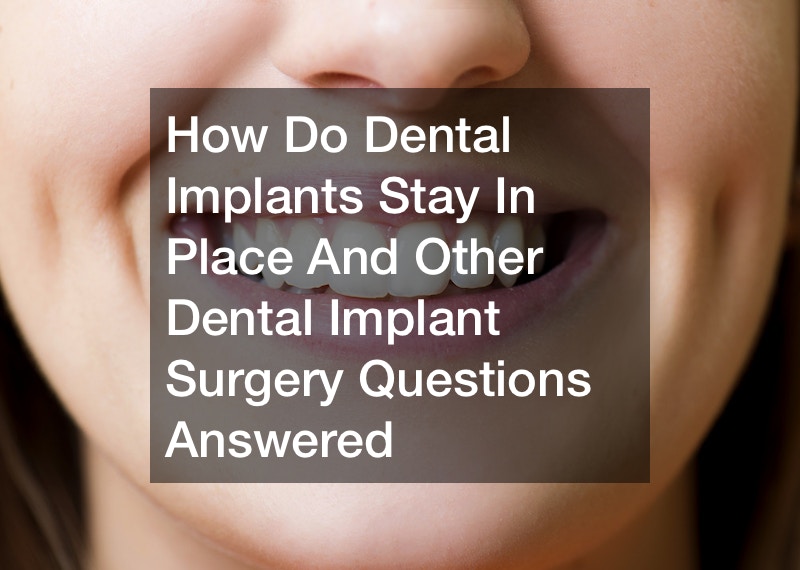 How Do Dental Implants Stay In Place And Other Dental Implant Surgery Questions Answered